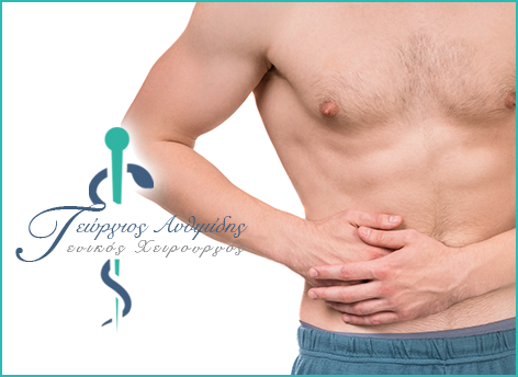 Appendicitis