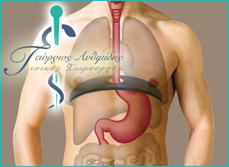 Gastro-oesophageal Reflux Disease