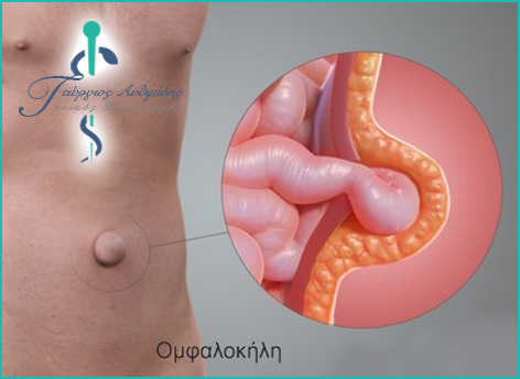 Protruding Intestines