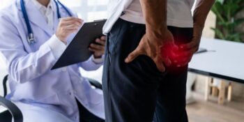 Αντιμετώπιση αιμορροΐδων